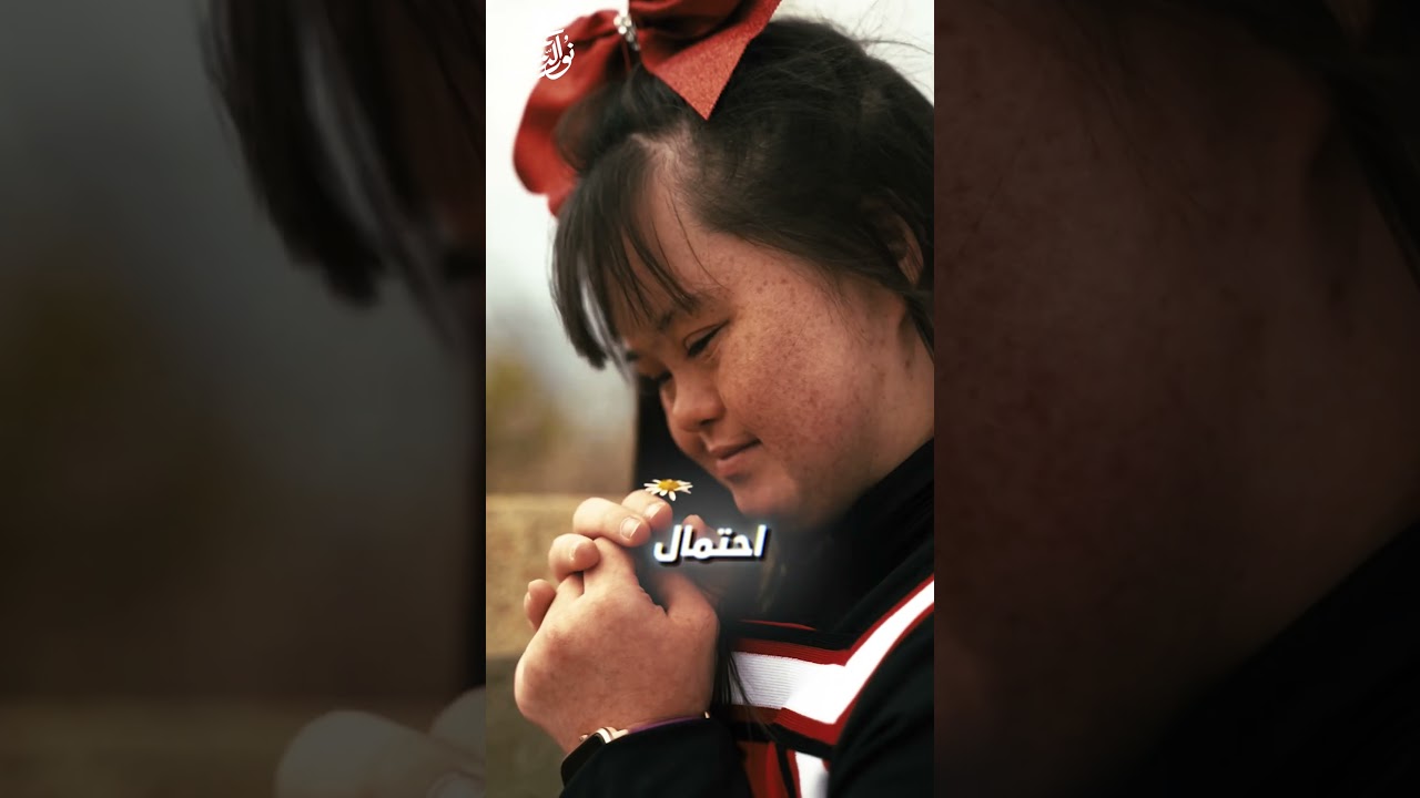لماذا ينجب بعض الناس أطفال مشوهين؟ ما ذنب الأطفال؟